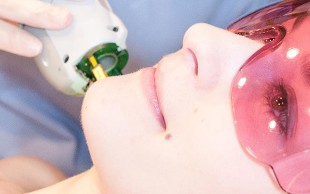 لیزر موهای زائد با دستگاه دایود کلینیک فاران استاتیک