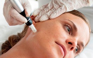 مزوتراپی مطب دکتر صفاریان