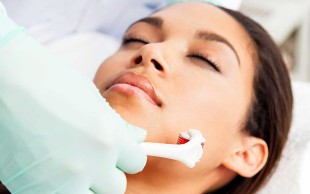 میکرونیدلینگ دکتر ادیب زاده