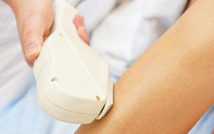 لیزر Elight  در مطب دکتر داوودآبادی