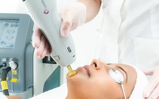 لیزر الکس کندلا در کلینیک ماهان