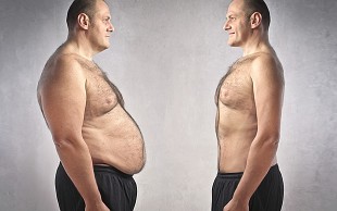 لاغری و لیفتینگ دکتر مطلبی