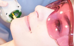 لیزر SHR در مرکز پوست تبسم