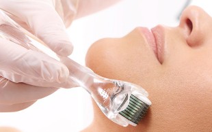 میکرونیدلینگ کلینیک تنا