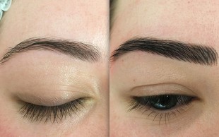 میکروپیگمنتیشن سالن الیا