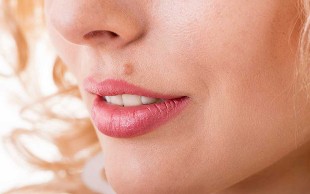 خالبرداری با دستگاه RF دکتر شمسی نژاد