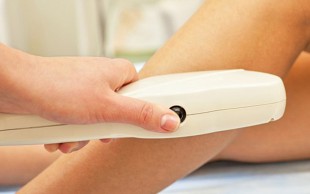 لیزر Elight  دکتر مطلبی