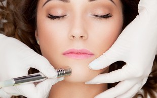 میکرودرم ابریژن در کلینیک آفتاب تابان