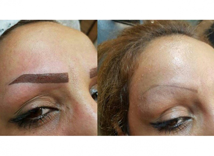 میکروپیگمنتیشن در سالن زیبایی سمیرا امیری