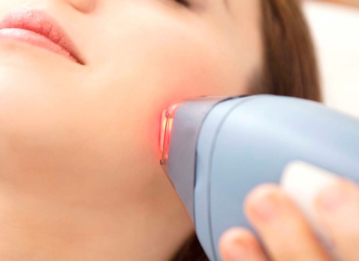 لیزر الکساندرایت کندلا در کلینیک رز