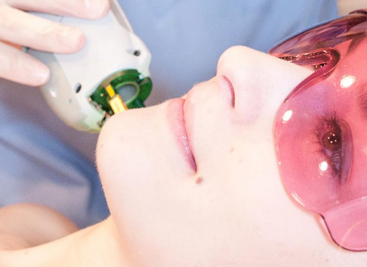 لیزر موهای زائد با دستگاه دایود کلینیک فاران استاتیک