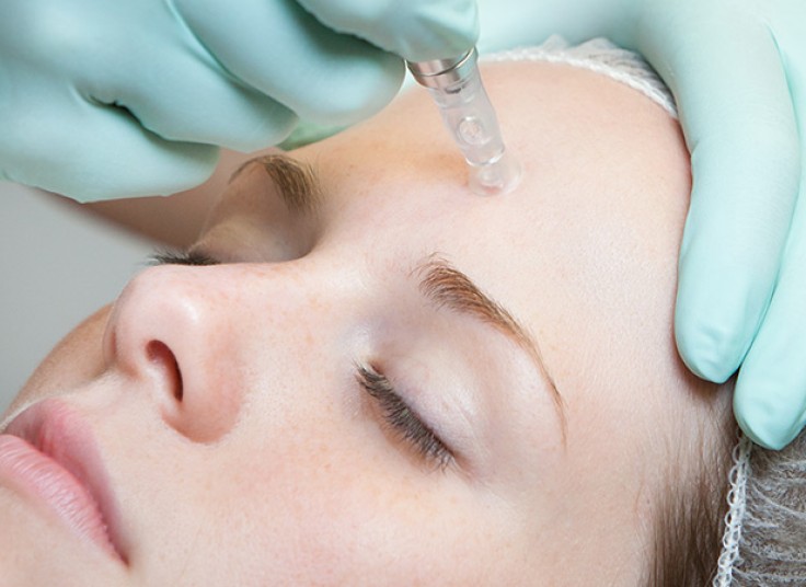 مزوتراپی سر و میکرونیدلینگ کلینیک ترنم