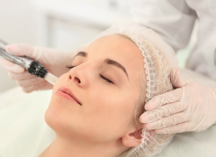 میکرونیدلینگ کلینیک تبسم