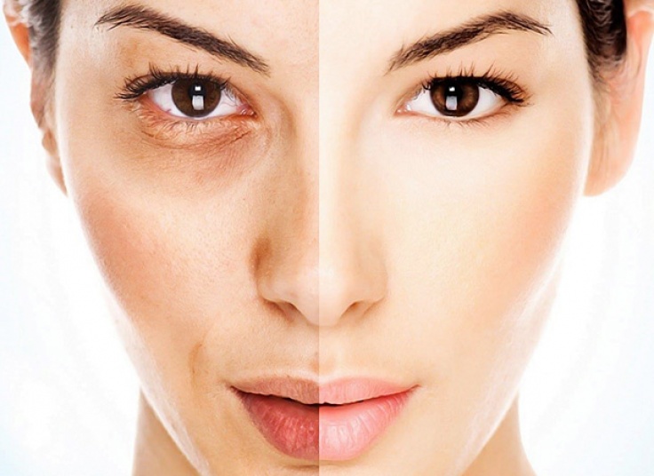 روشن سازی بدن در مطب دکتر سهرابی