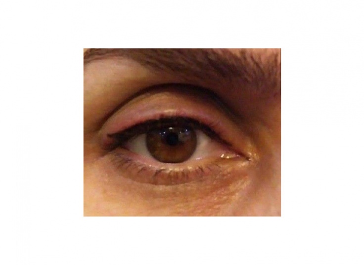 میکروپیگمنتیشن مجموعه افسانه