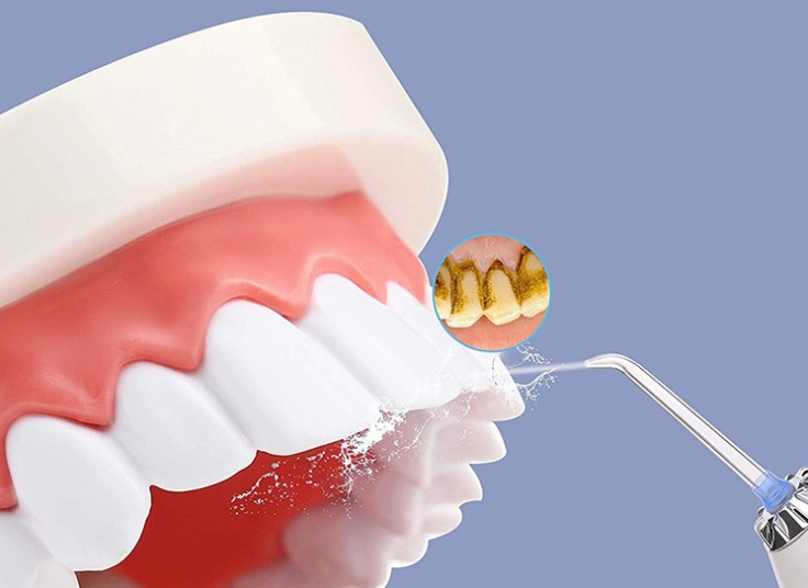 واتر جت شستشوی دهان و دندان h2ofloss