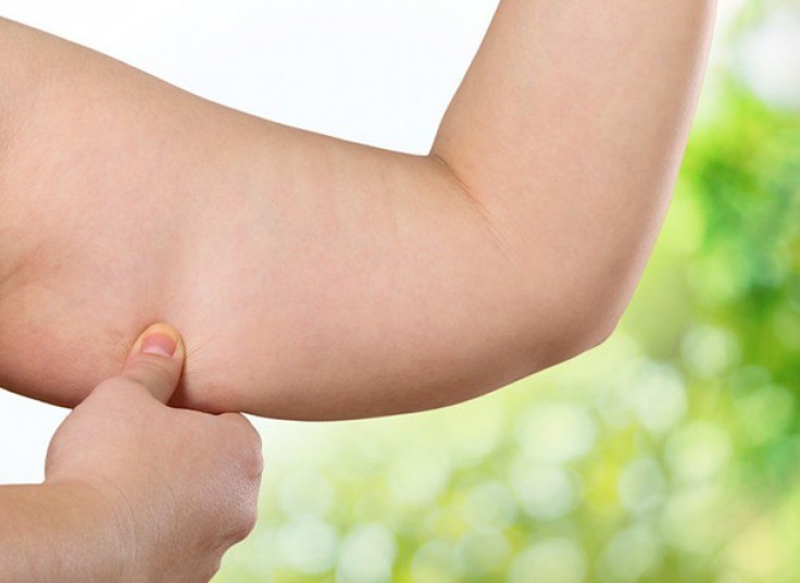 کرایولیپولیز 2016 وکیوم دار در مرکز لاغری عارف