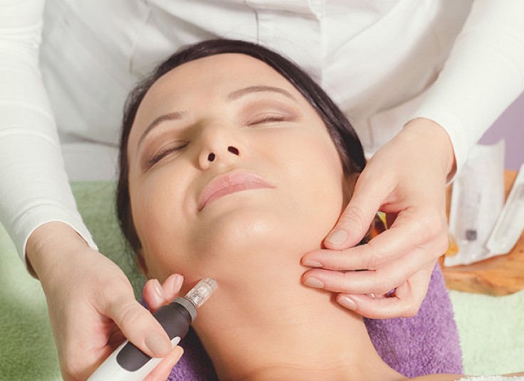 میکرونیدلینگ در کلینیک آدینا