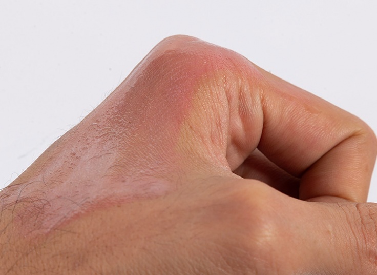 رژگونه مایع حرارتی Rimocoo