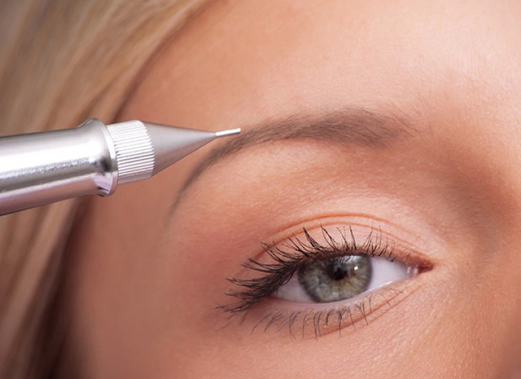 میکروپیگمنتیشن سالن لیانا