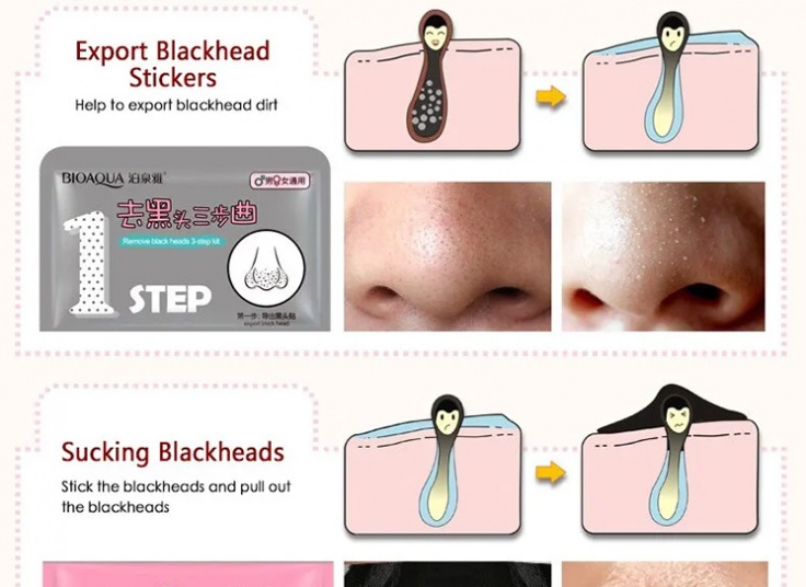 ماسک بینی بایو آکوا