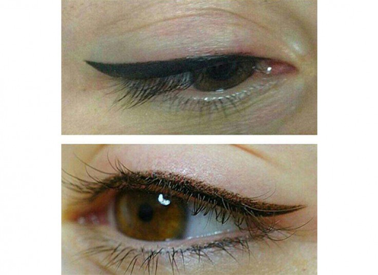 میکروپیگمنتیشن سالن نیلای