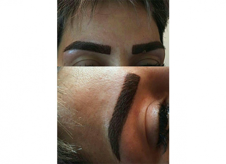 میکروپیگمنتیشن سالن الیا