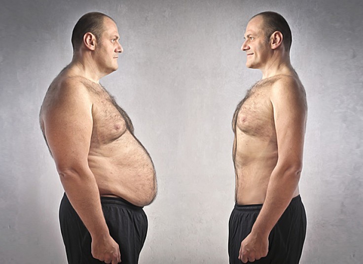 لاغری و لیفتینگ دکتر مطلبی