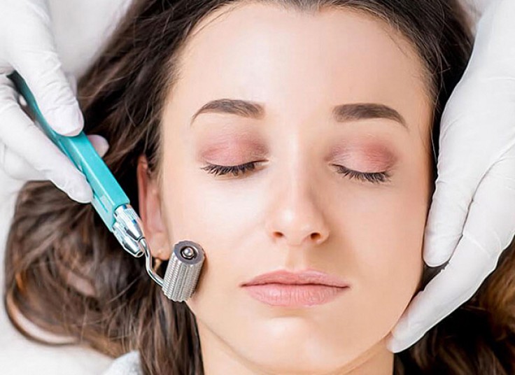 میکرونیدلینگ در مرکز گلدیس