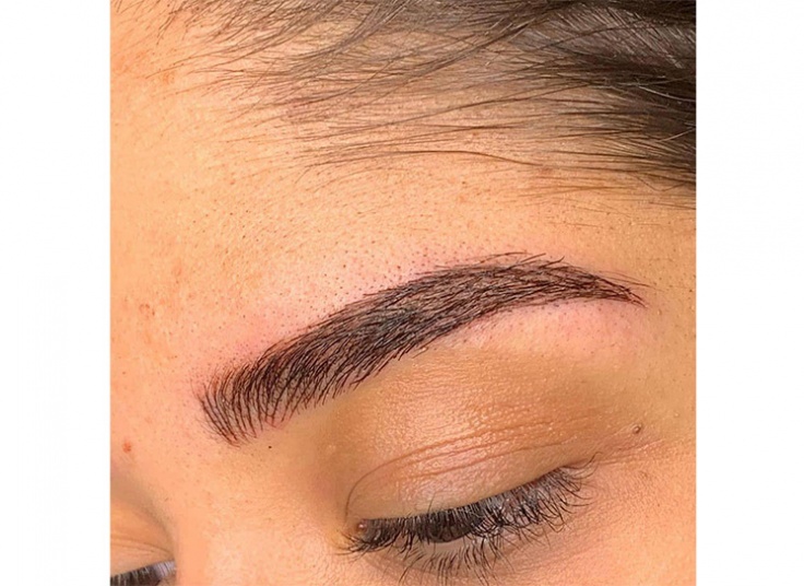 میکروپیگمنتیشن سالن لیانا