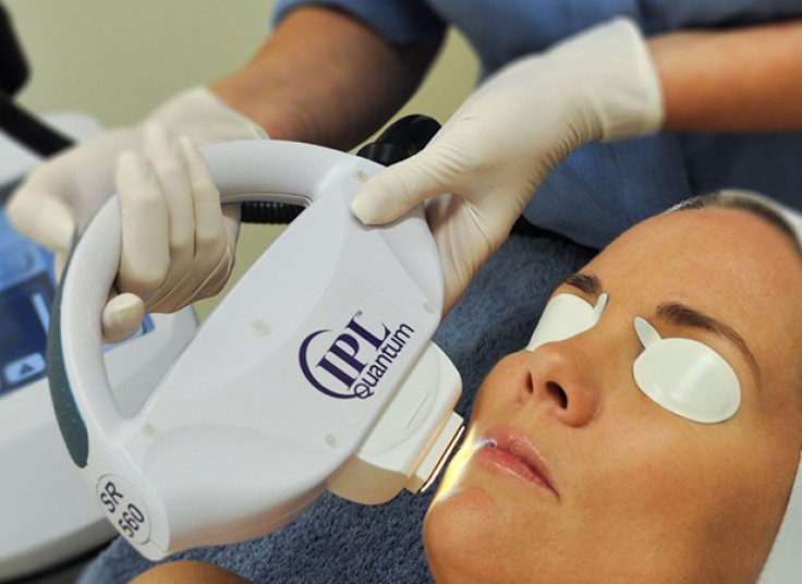 لیزر موهای زائد در مطب دکتر عبدالحسین زاده