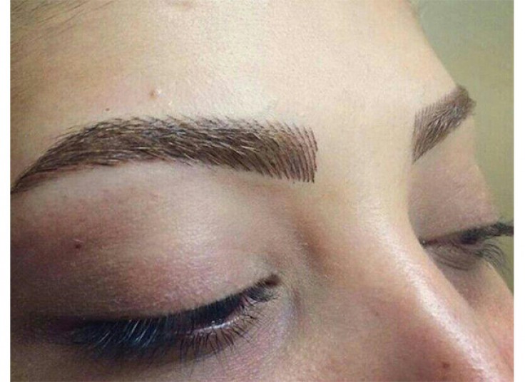 میکروپیگمنتیشن سالن نیلای