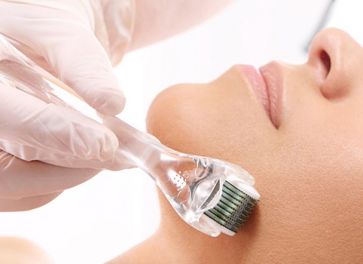 میکرونیدلینگ کلینیک تنا