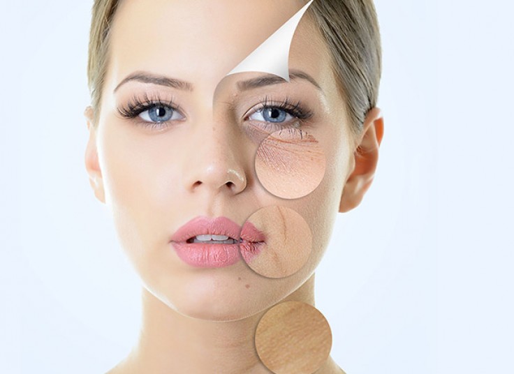 کربوکسی تراپی در مطب دکتر مطلبی