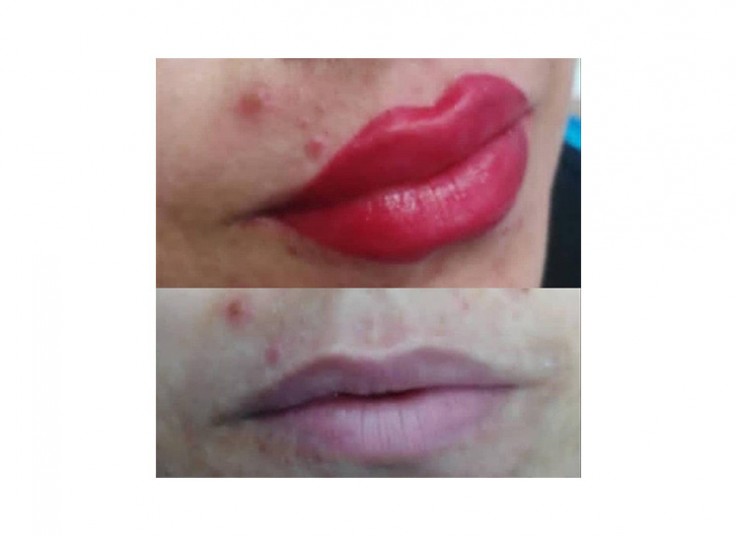 میکروپیگمنتیشن سحر