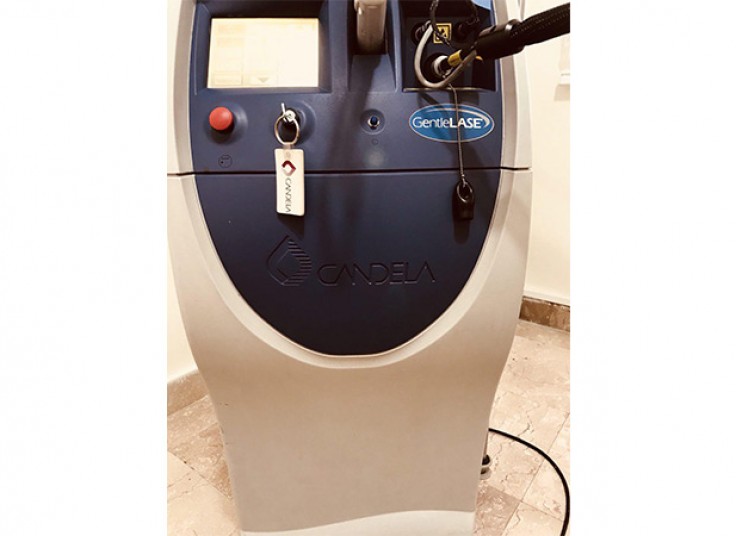 لیزر الکس کندلا نسیم غرب