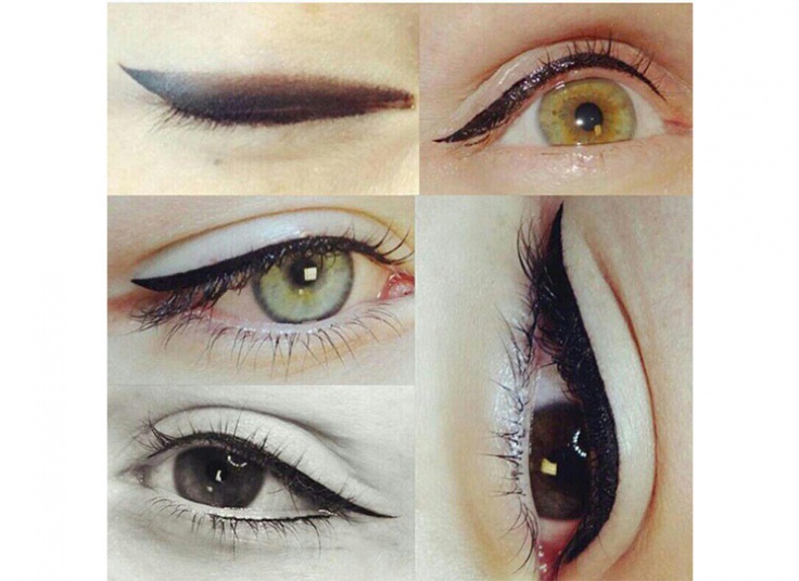 میکروپیگمنتیشن سالن نیلای