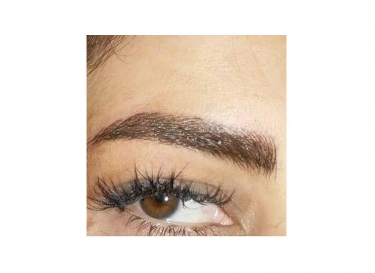 میکروپیگمنتیشن مجموعه افسانه