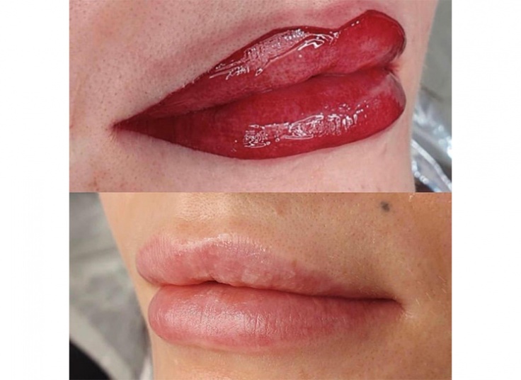 میکروپیگمنتیشن در سالن زیبایی هیوا