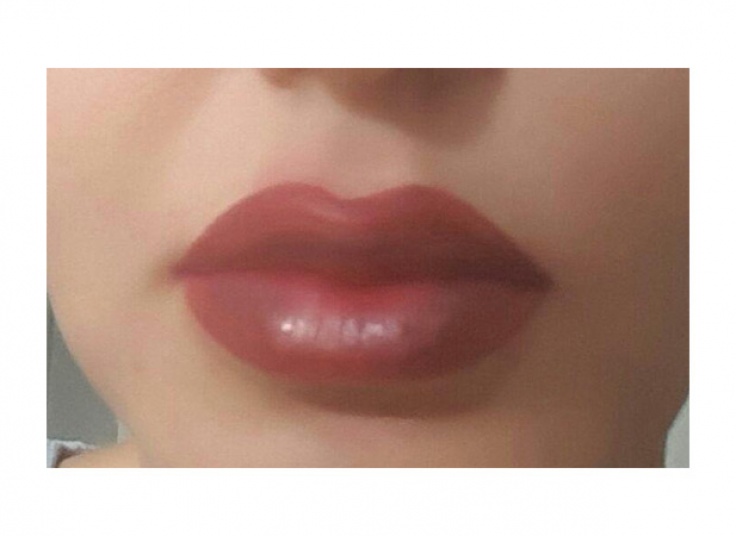 میکروپیگمنتیشن سالن الیا