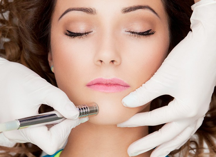 میکرودرم ابریژن در کلینیک آفتاب تابان