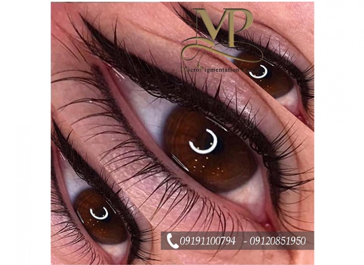 مرکز تخصصی تتو MP