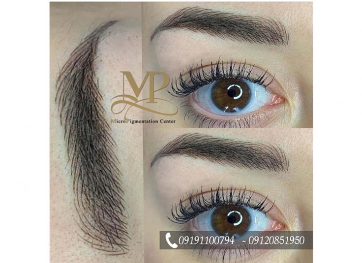 مرکز تخصصی تتو MP