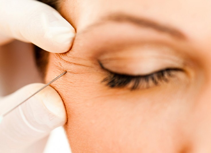 بوتاکس در مطب دکتر دهقانیان