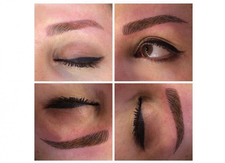 میکروپیگمنتیشن سالن نیلای