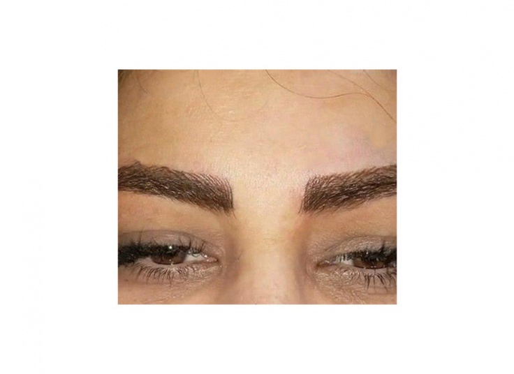 میکروپیگمنتیشن مجموعه افسانه